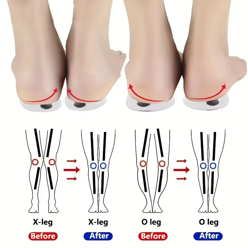 Women Shoes Types - 1 زوج النعال العظام للأقدام O/X